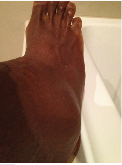 Serena-ankle