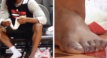 Rockets James Harden’s toe game could use some maintenance [photo]