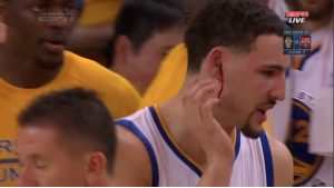 Klay-Ear-Bleed