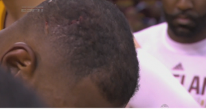 Lebron's head